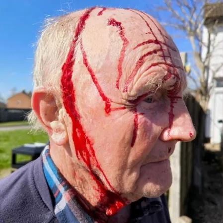 75歲的退休人士Jim Hewitt於本月1日外出買東西時遇襲,頭部血流如注。(X)