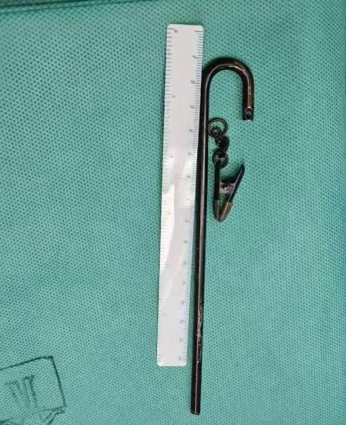 內地男酒後摔倒鐵桿插入口 直穿顱內緊急送院搶救(網圖)