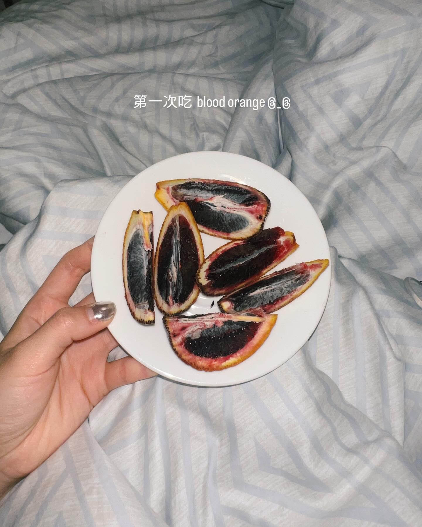 袁澧林因為發高燒入院,因而缺席「第四十九屆香港國際電影節」開幕典禮。