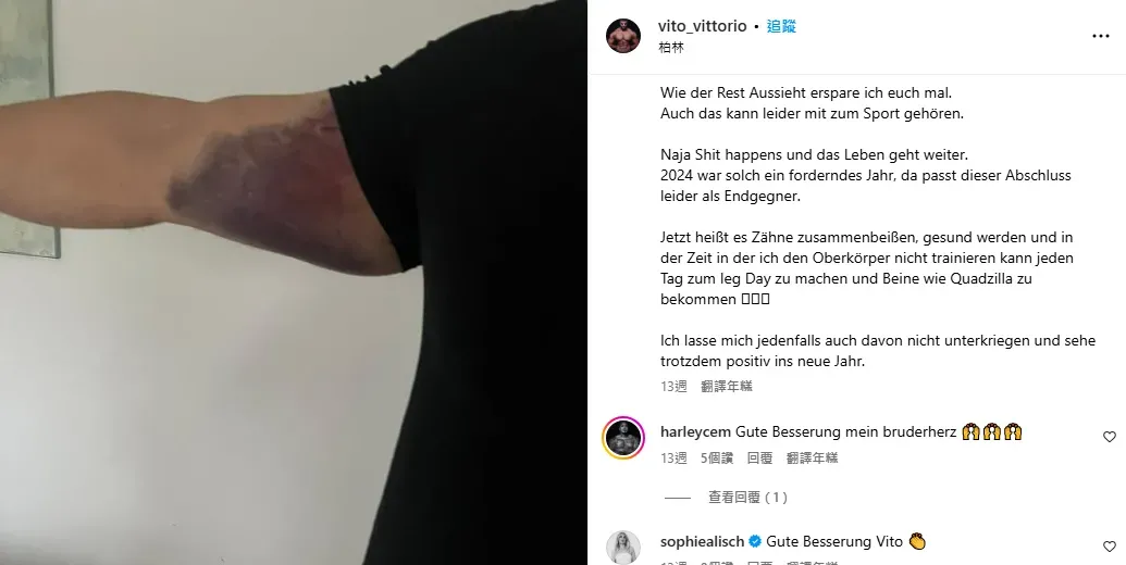 Vittorio Pirbazari去年底胸大肌撕裂。