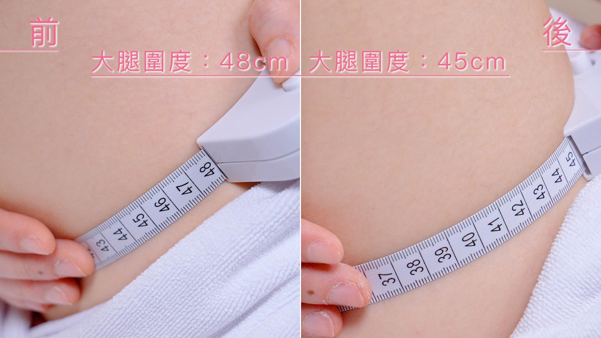 「熱磁筋膜刀」效果對比