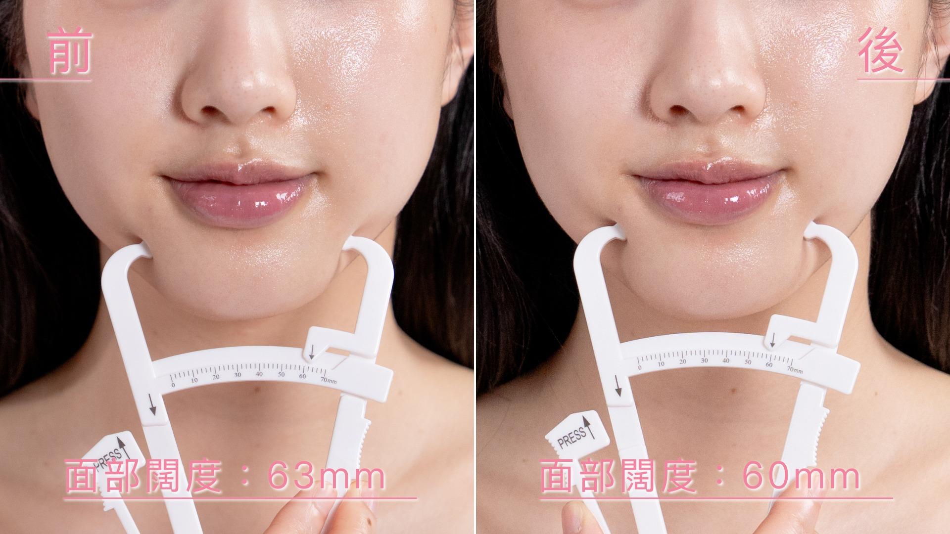 i-YOGA「電波撥筋小顏刀」對比