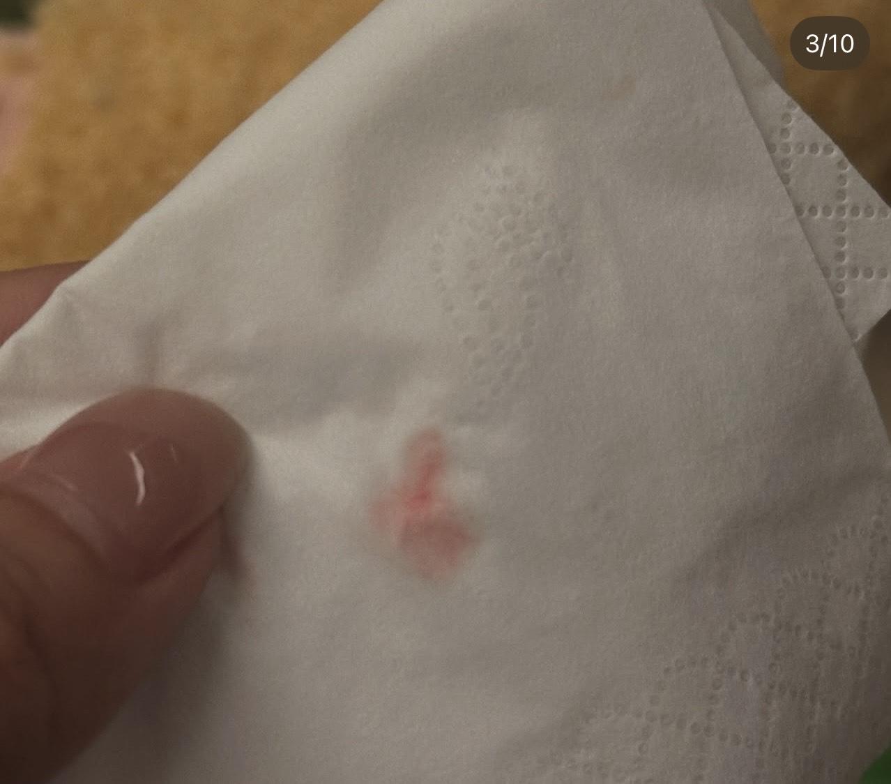 BeBe 第一次鼻子出血。