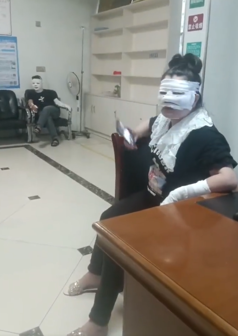 北京近日有市民野外燒烤時,所利用的手提卡式石油氣爐突然爆炸,造成兩家人7人不同程度燙傷。事後傷者臉部紮上繃帶被包成「木乃伊」。(微博)