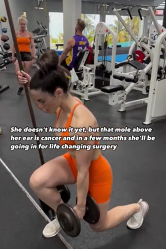 片段中的安傑利已出現癌徵。(互聯網)