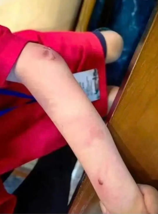 內媒引消息稱,朱宏鑫的單親父親嚴苛催谷其棋藝長期虐打,手臂上有明顯傷痕,近日賽事失利後更遭父親當眾「穿心腿」,網民稱長期家暴或為悲劇誘因。(網上圖片)