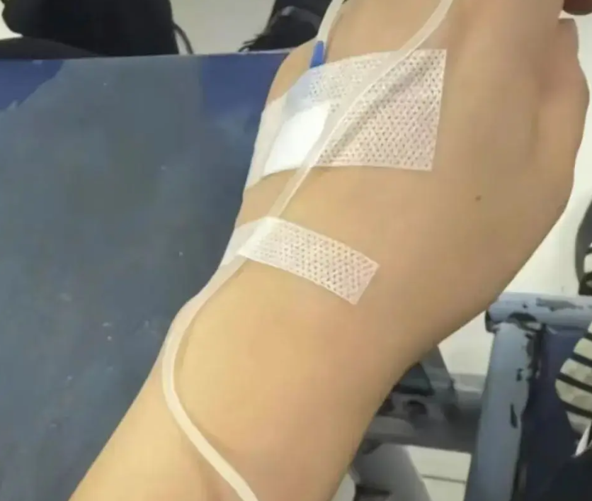 安徽省亳州市蒙城縣發生集體食物中毒事件,當地一間女網紅的流動攤檔近日出售意大利甜品提拉米蘇(Tiramisu),超過百名民眾食用後腹瀉、發燒、嘔吐,部份人要入院治療涉事女網紅已將網上平台賬號設為私密狀態,稱會配合政府調查。當地市監局已介入調查。