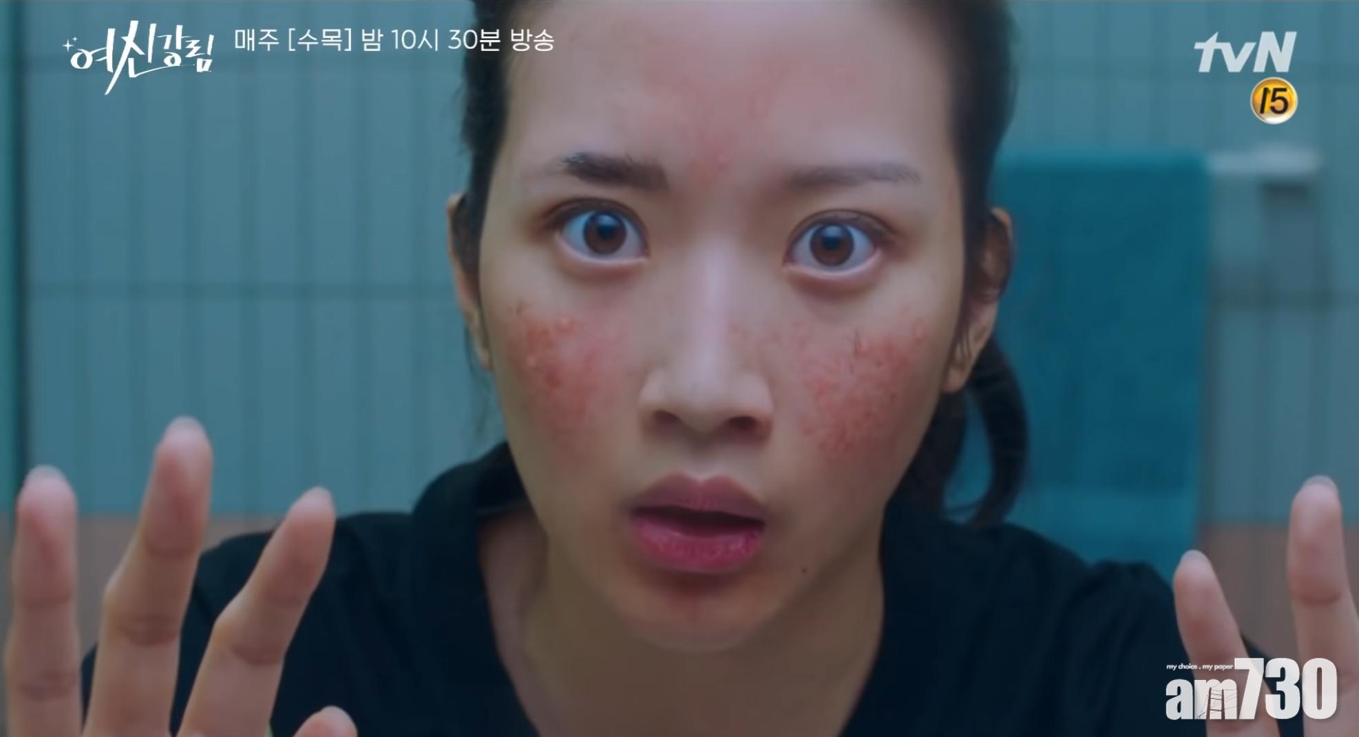 暗瘡問題太過嚴重,便不建議使用針清。