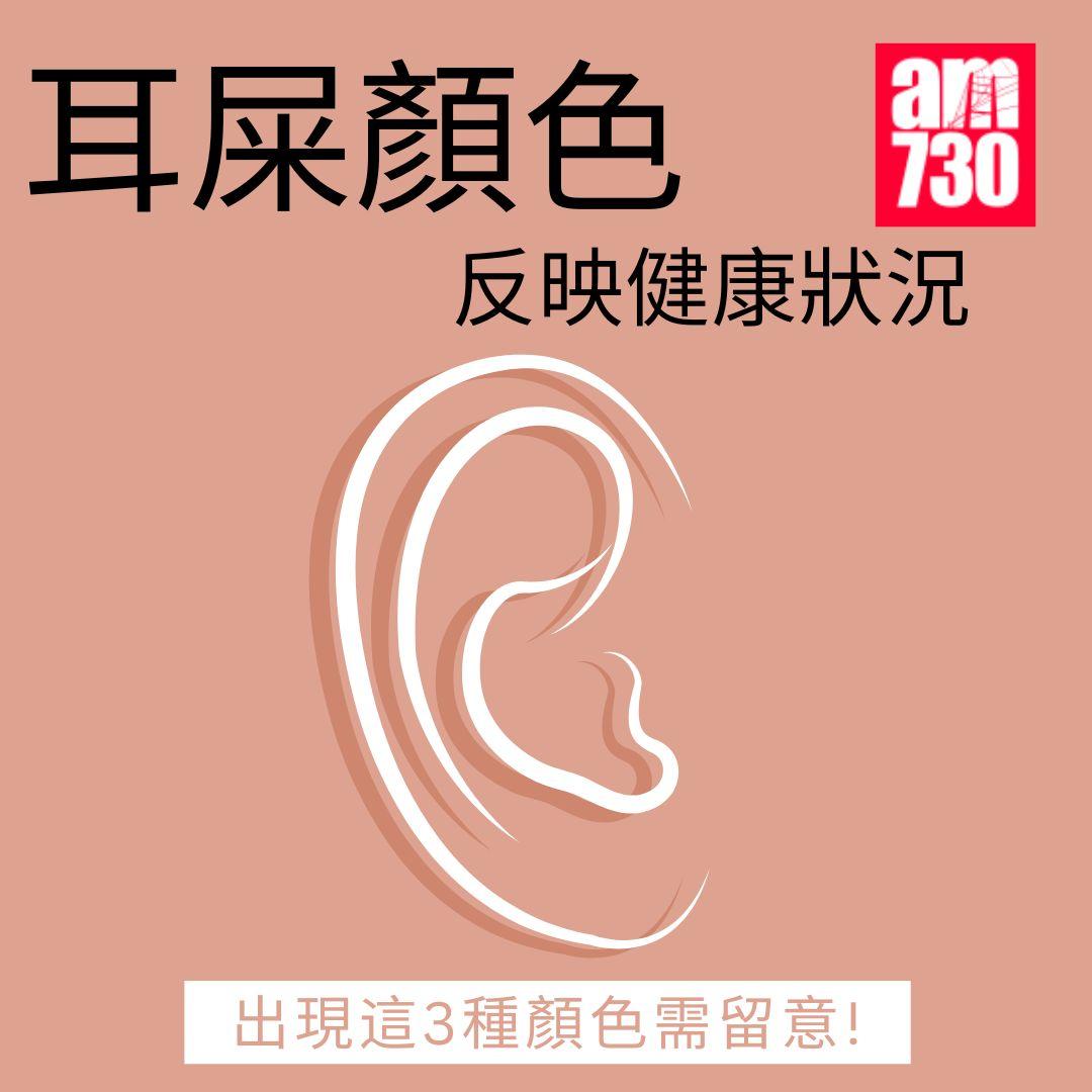 耳屎顏色反映健康狀況 出現這3種顏色需留意!