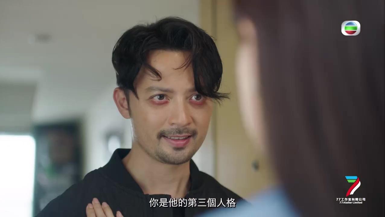 Ronny對「熊貓眼」令觀眾大感好奇。