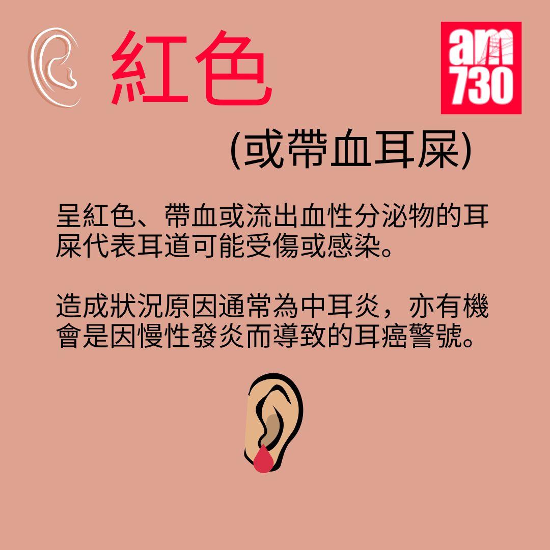 耳屎顏色反映健康狀況 出現這3種顏色需留意!