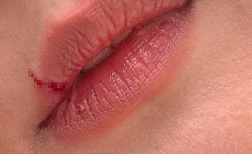 傷口位置(@Threads/ lanny_day49)