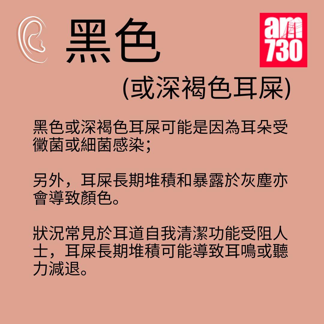 耳屎顏色反映健康狀況 出現這3種顏色需留意!