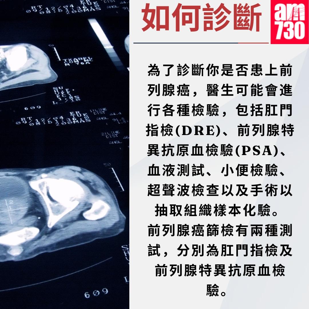 前列腺癌症狀/治療/預防方法懶人包|(am730製圖)