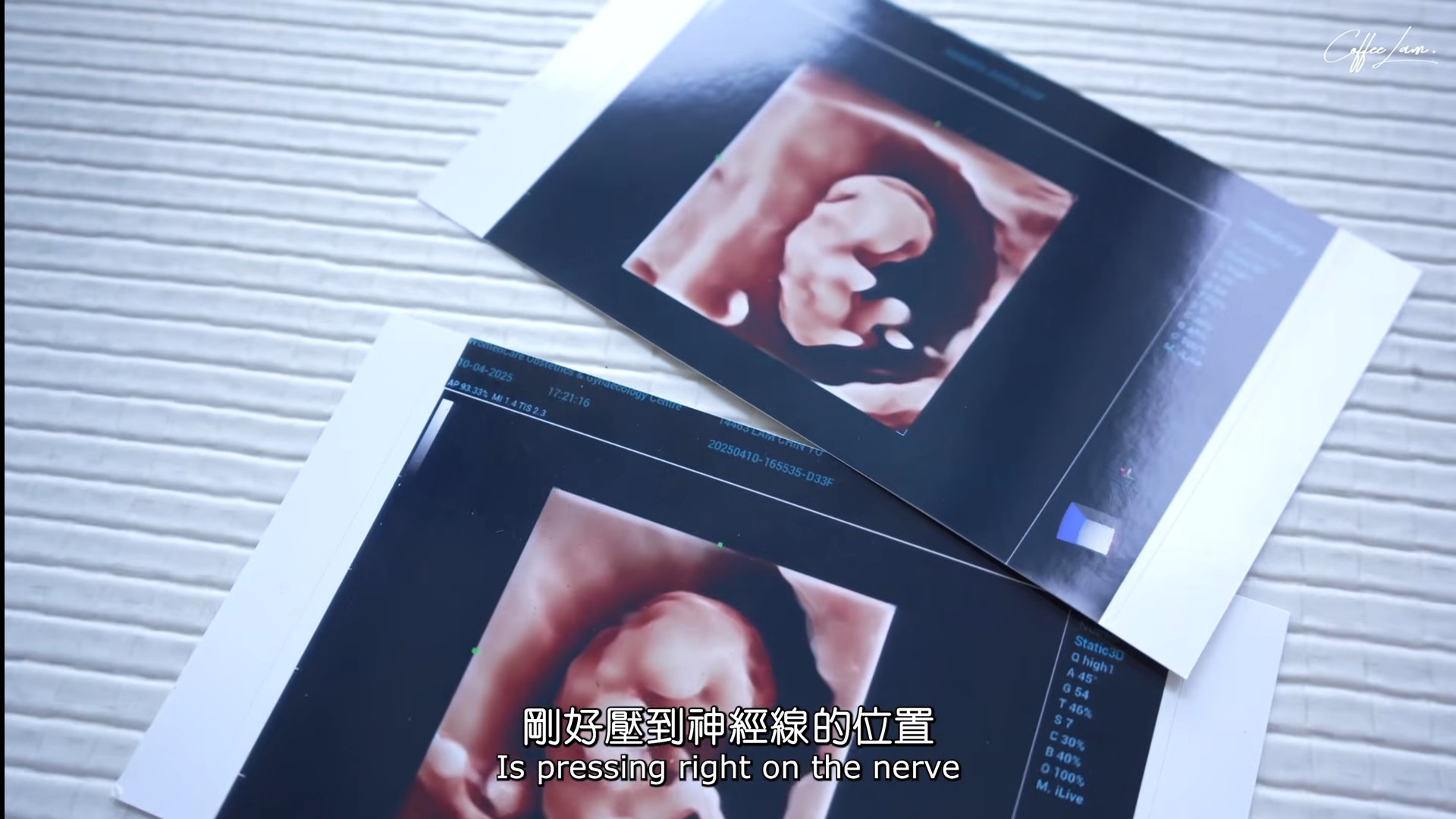 Coffee拍片分享她今次懷孕的狀況。