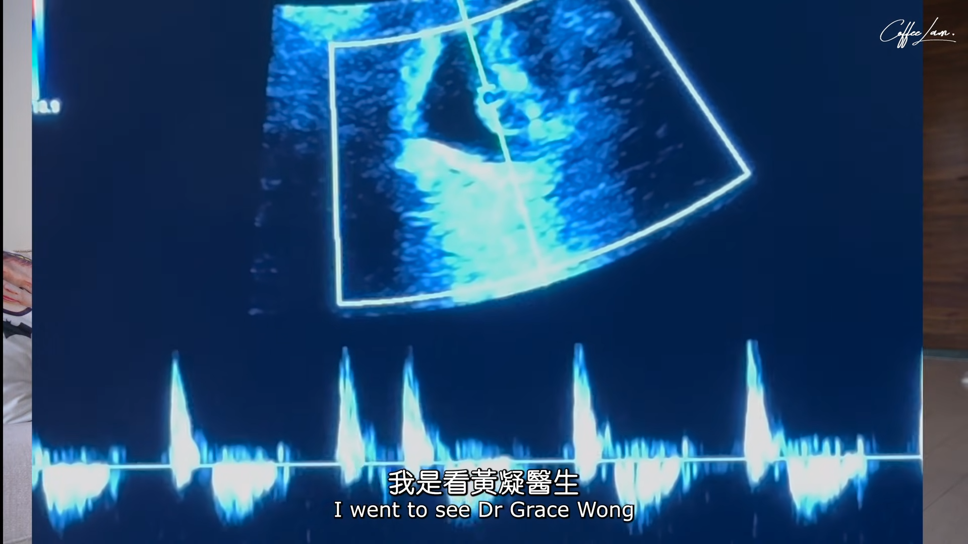 Coffee拍片分享她今次懷孕的狀況。