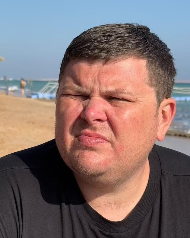 埃利斯說,這次觸電令他有後遺症,影響日常工作。(互聯網)