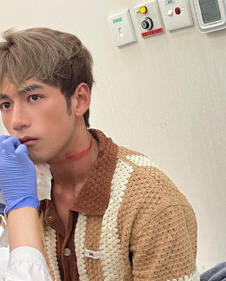 Jeffrey動脈位置出現長約8吋血痕,傷勢看似頗嚴重。