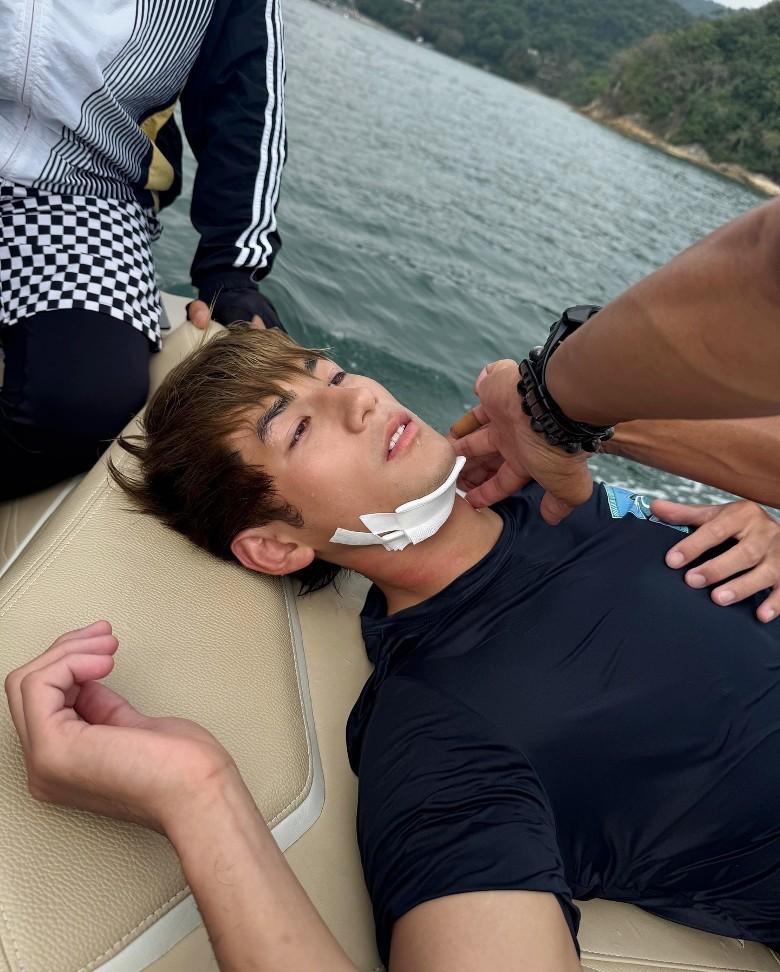 Jeffrey拍戲遇嚴重意外。