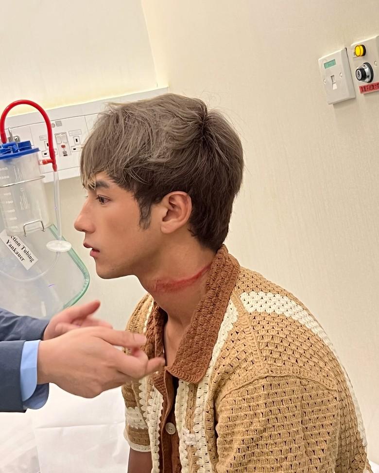 Jeffrey動脈位置出現長約8吋血痕,傷勢看似頗嚴重。