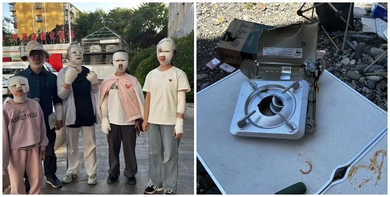 北京近日有市民野外燒烤時,所利用的手提卡式石油氣爐突然爆炸,造成兩家人7人不同程度燙傷。事後傷者臉部紮上繃帶被包成「木乃伊」。(微博)