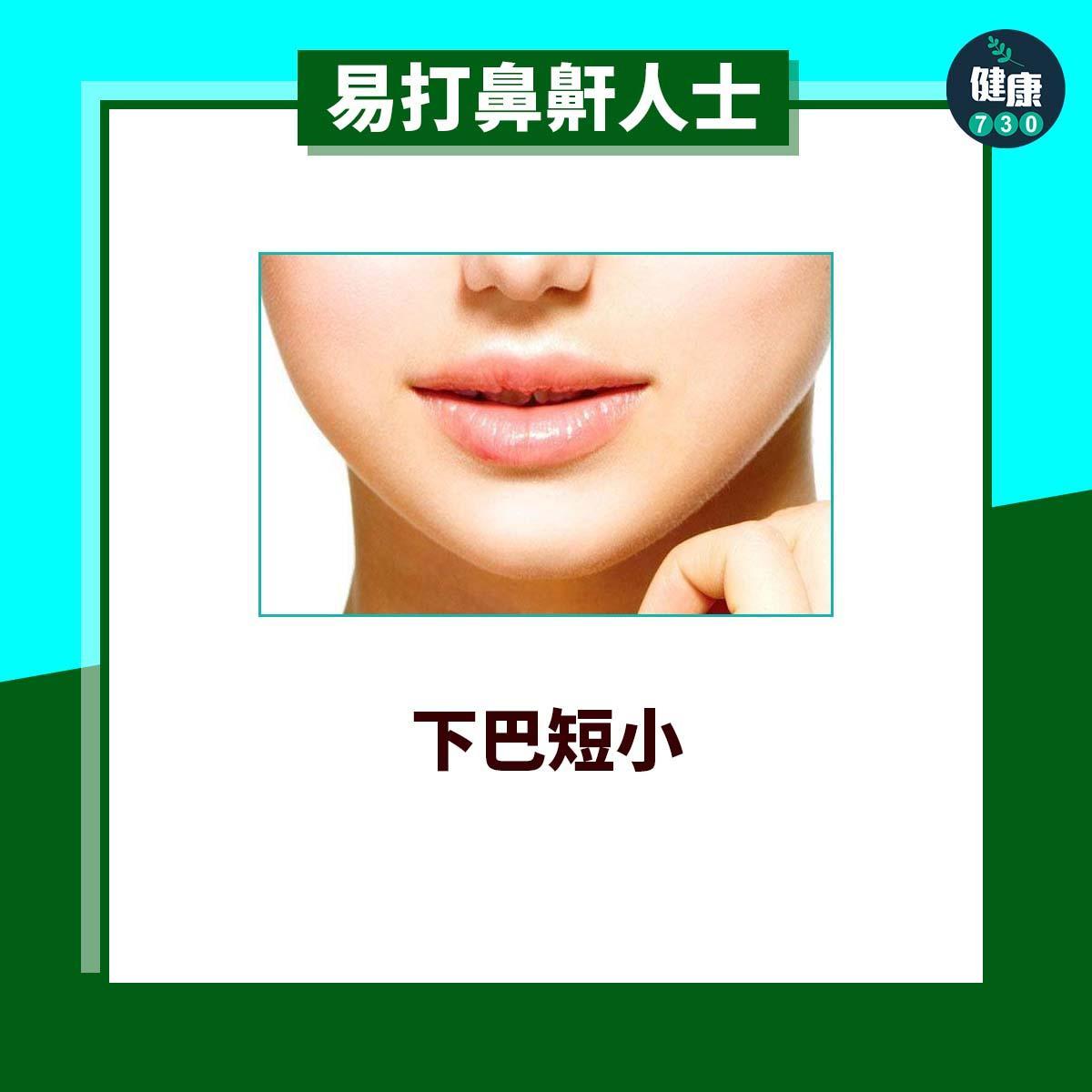 易打鼻鼾人士|下巴短小(am730製圖)