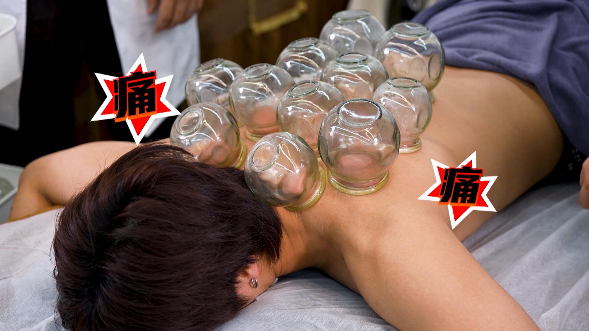 希晉@ROVER接受人生第一次拔罐治療,期間不停大叫「好痛」。