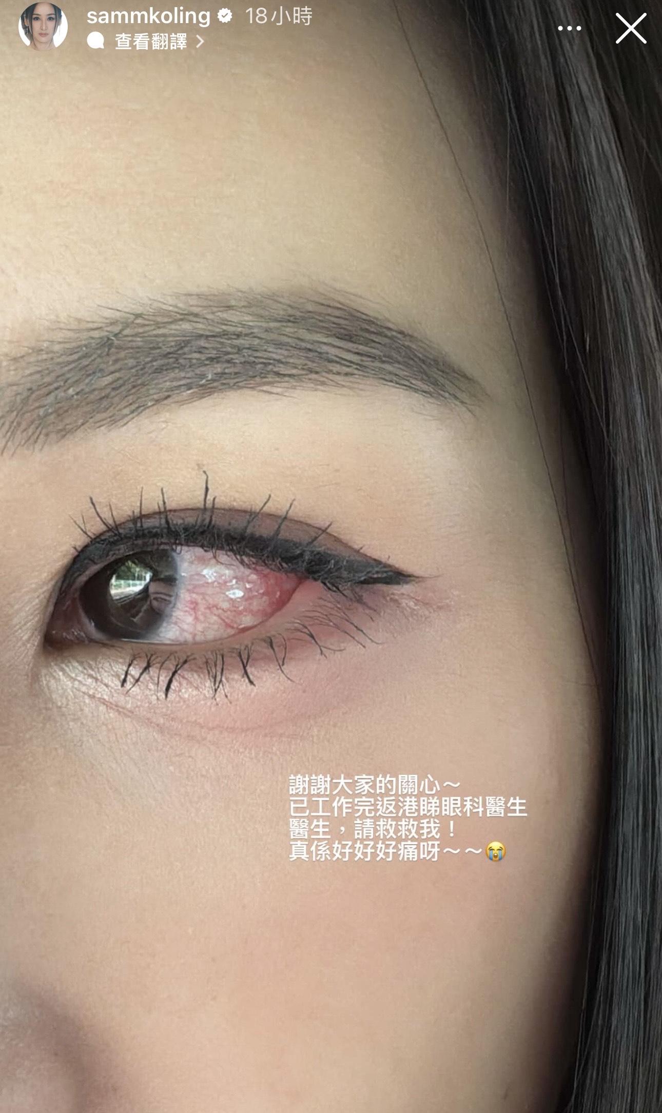 網民估計高海寧的免疫系統出現了問題。