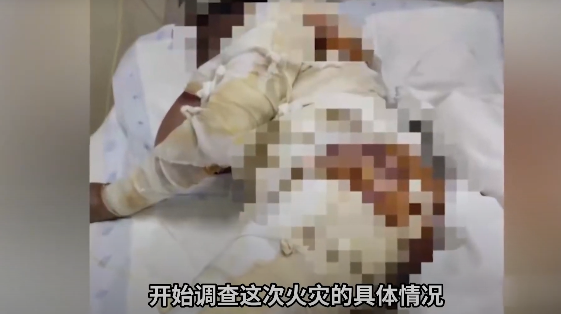 雲南宣威男子陳繼衛因家庭糾紛,在家中將汽油潑向妻子禹秀英並點燃,導致禹秀英全身55%遭到燒傷。禹秀英經過4個月的搶救,最終因感染中毒不幸離世。