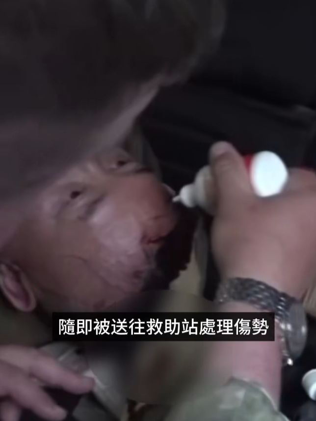 香港鳳凰衛視報道,當地周四(26日)下午,正在俄羅斯庫爾斯克地區採訪的鳳凰衛視記者盧宇光一行,遇到針對當地設施的烏克蘭無人機襲擊。當時正在採訪工作中的盧宇光頭部受傷,隨即被送往救助站處理傷勢,之後轉送往庫爾斯克市醫院進行進一步檢查治療。(影片截圖)