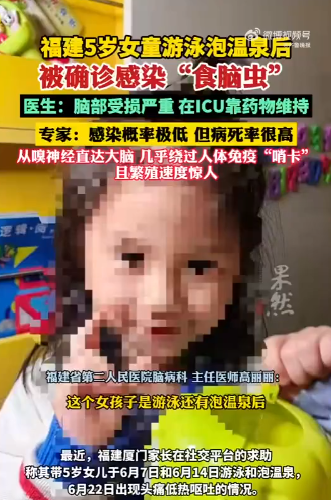 福建省一名5歲女童在游泳和泡溫泉後,竟感染罕見的「食腦蟲」。