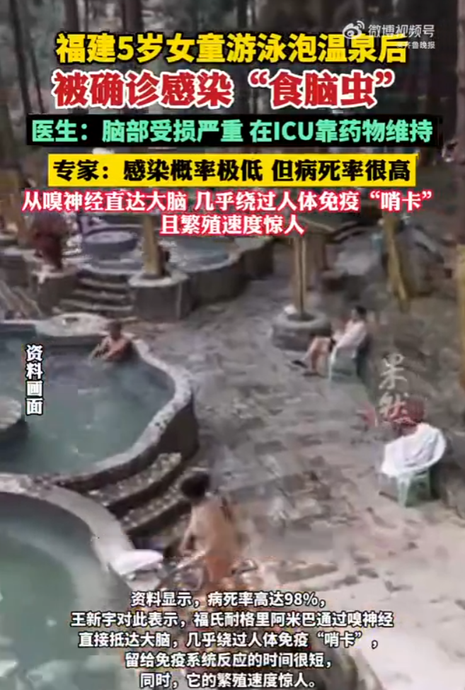 此外,醫生也強調,海水因含有較高鹽分,以及正規游泳池因具有充足餘氯,這兩種環境較不易滋生阿米巴,感染案例極為罕見。