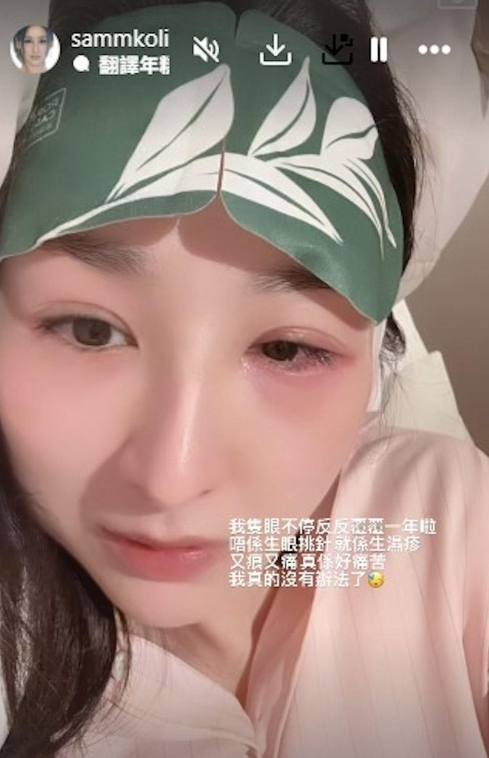 高海寧再受眼疾困擾一年,大嗌救命。