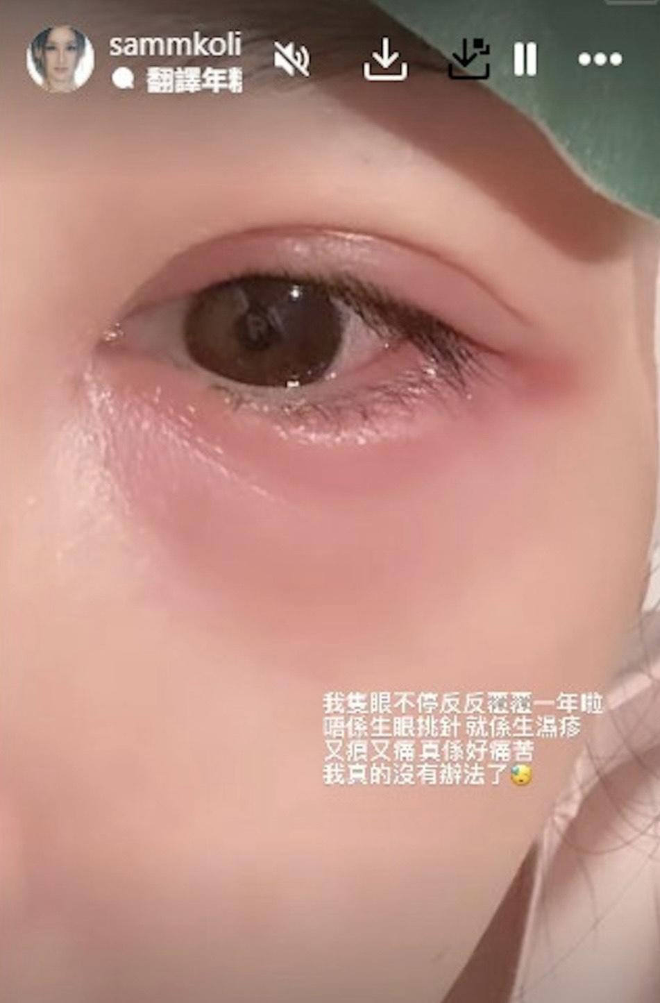 高海寧眼睛又紅又腫。