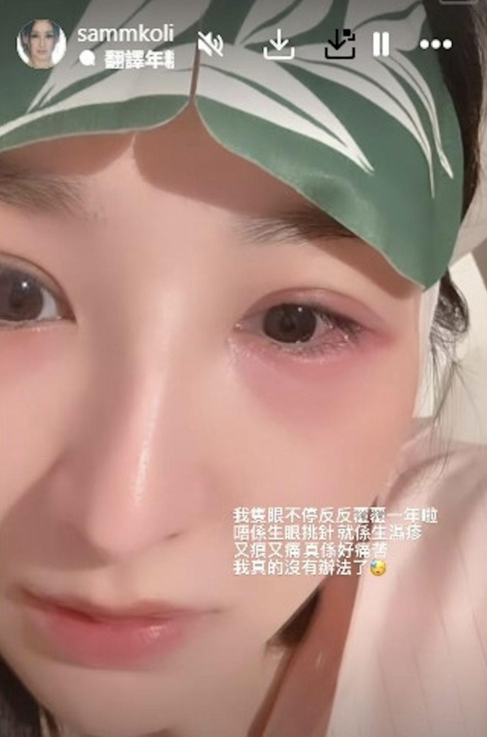 高海寧近年身體不停響起警號 。