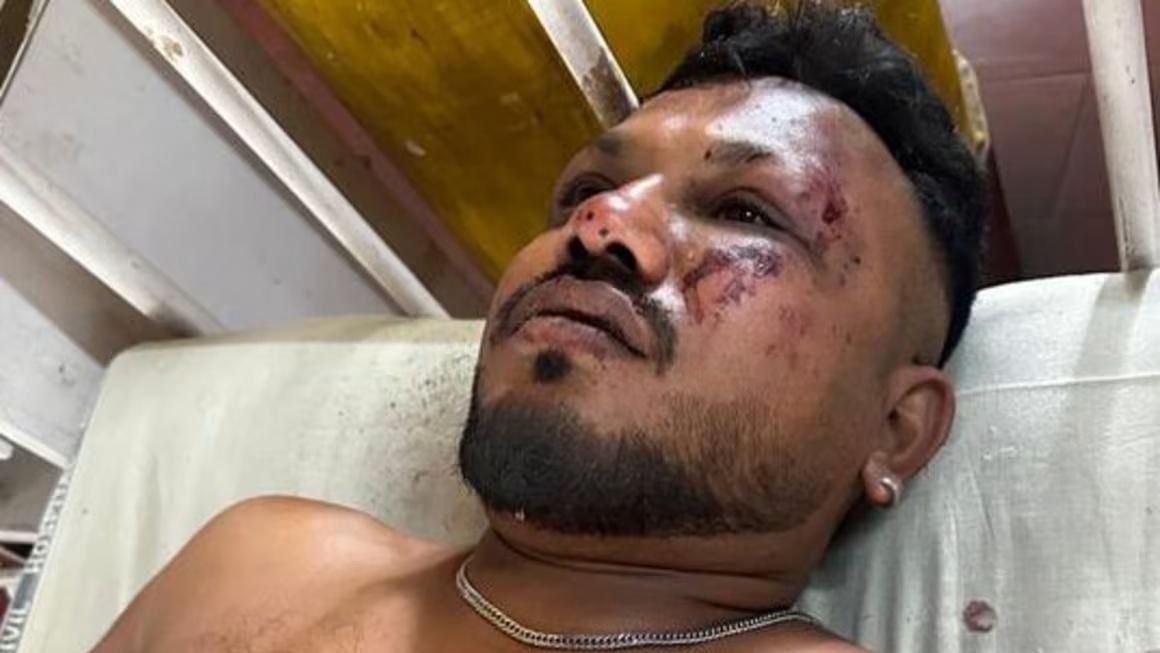 醫院指Vishwash Kumar Ramesh傷勢無大礙,料幾天後可出院。(X)