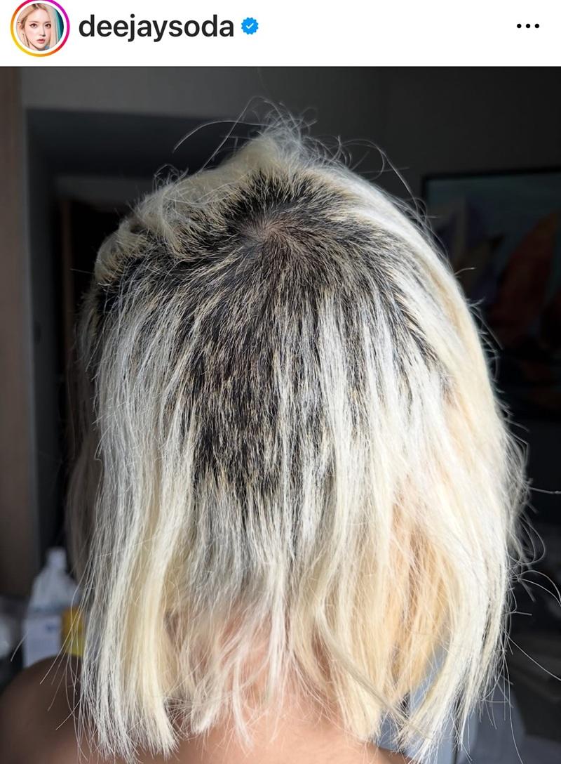 DJ Soda在IG分享脫髮照訴苦。