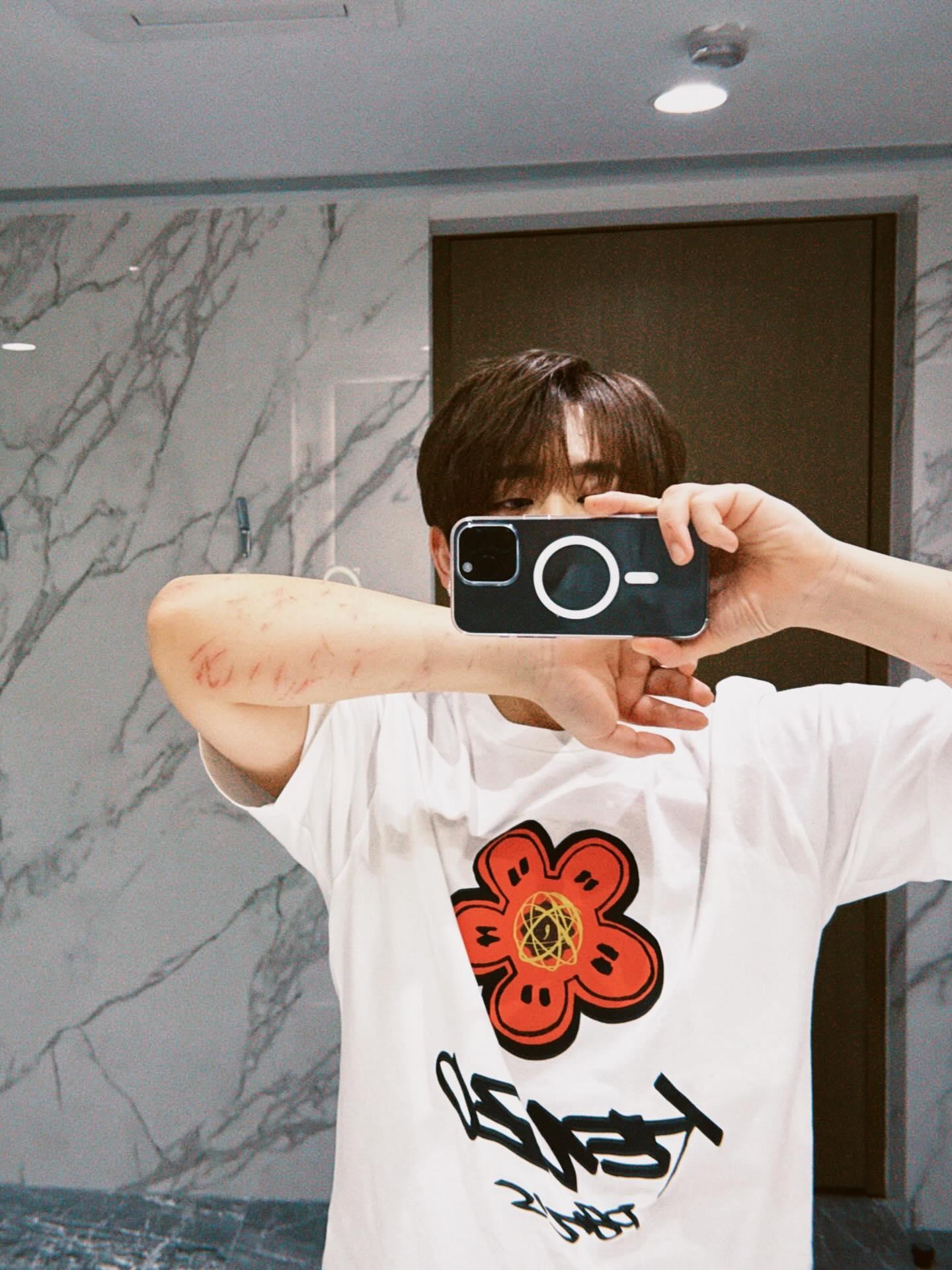 姜濤展示雙手的傷痕。