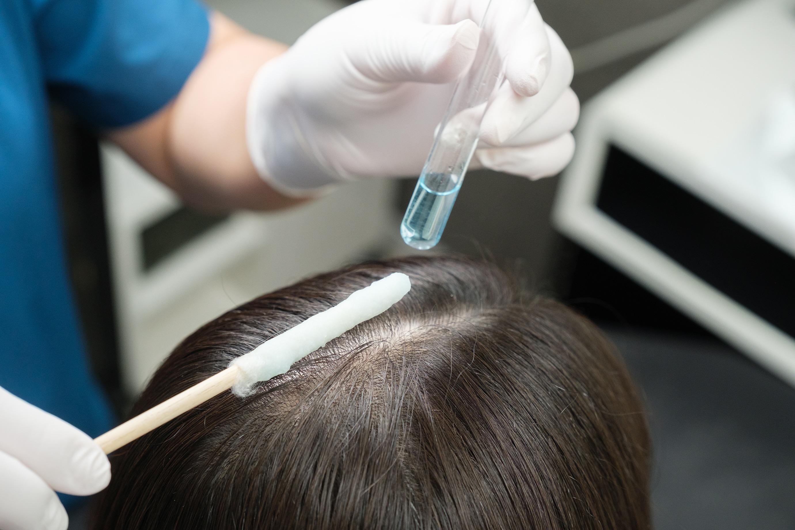 父親節禮物2025|史雲遜Svenson INDIBA + NMN專利西班牙護髮生髮療程