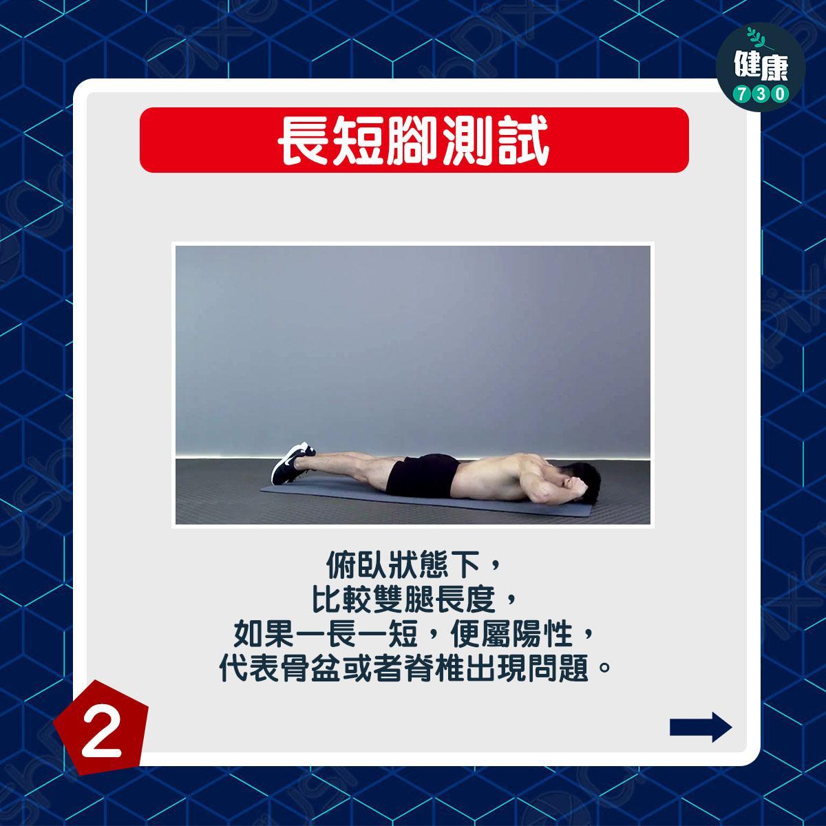 椎間盤突出測試丨長短腳測試:俯臥狀態下,比較雙腿長度,如果一長一短,便屬陽性,代表骨盆或者脊椎出現問題。(am730製圖)