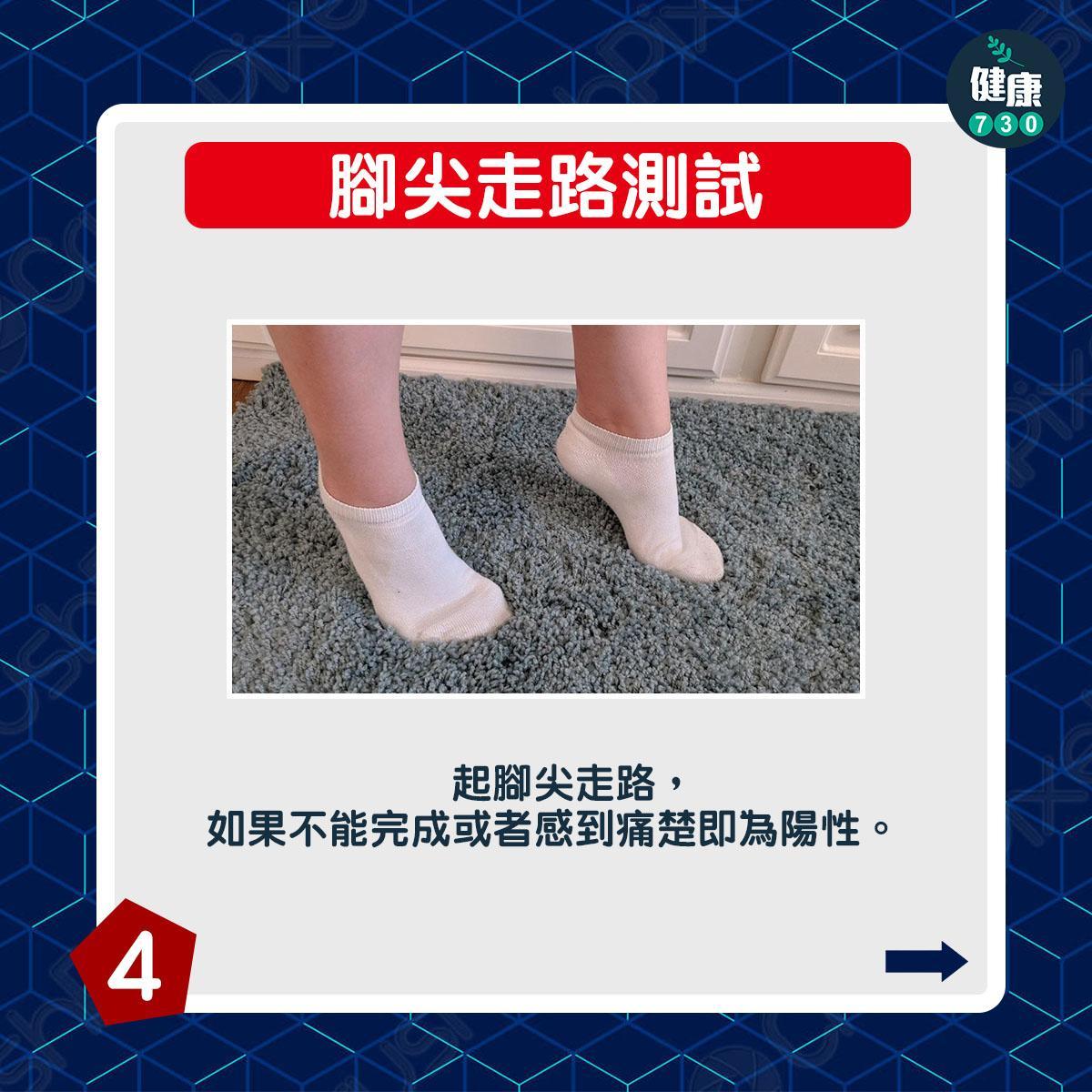 椎間盤突出測試丨腳尖走路測試:踮起腳尖走路,如果不能完成或者感到痛楚即為陽性。(am730製圖)