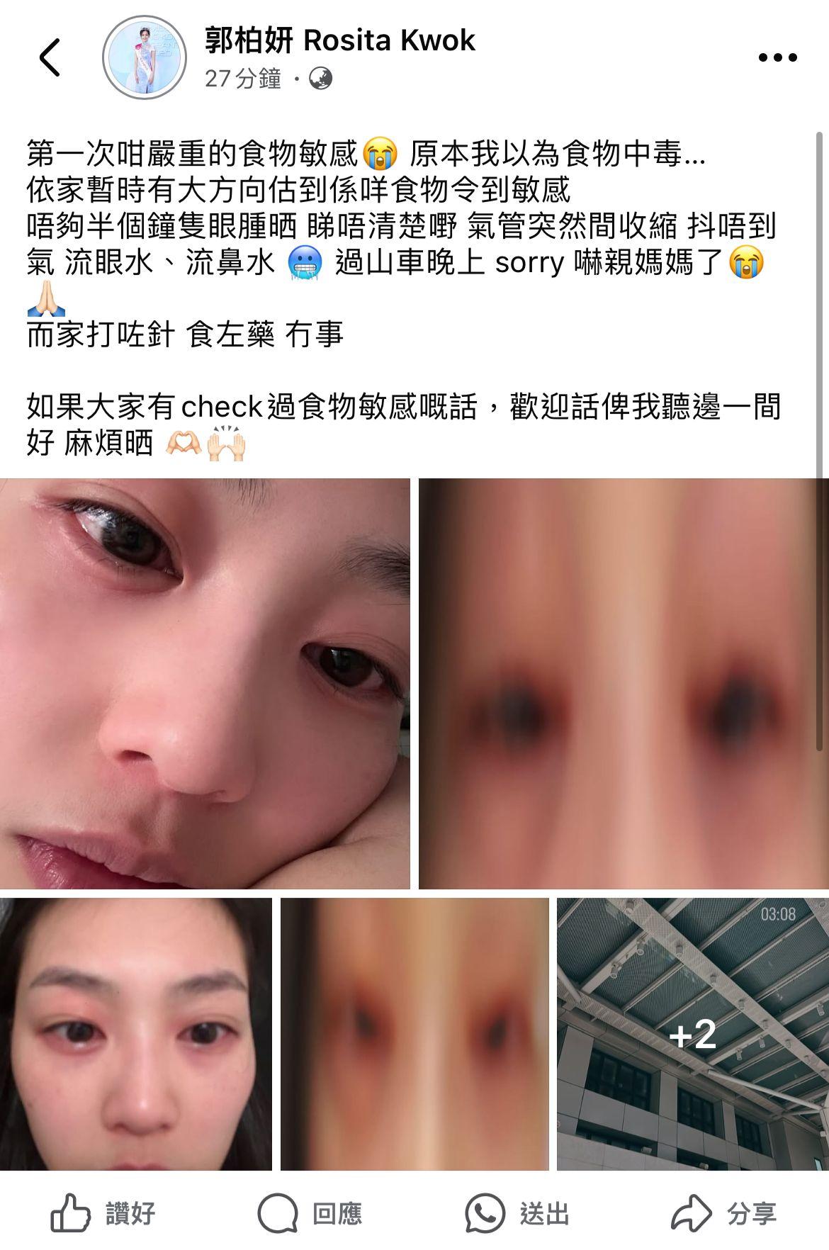 郭柏妍在社交平台交代情況。