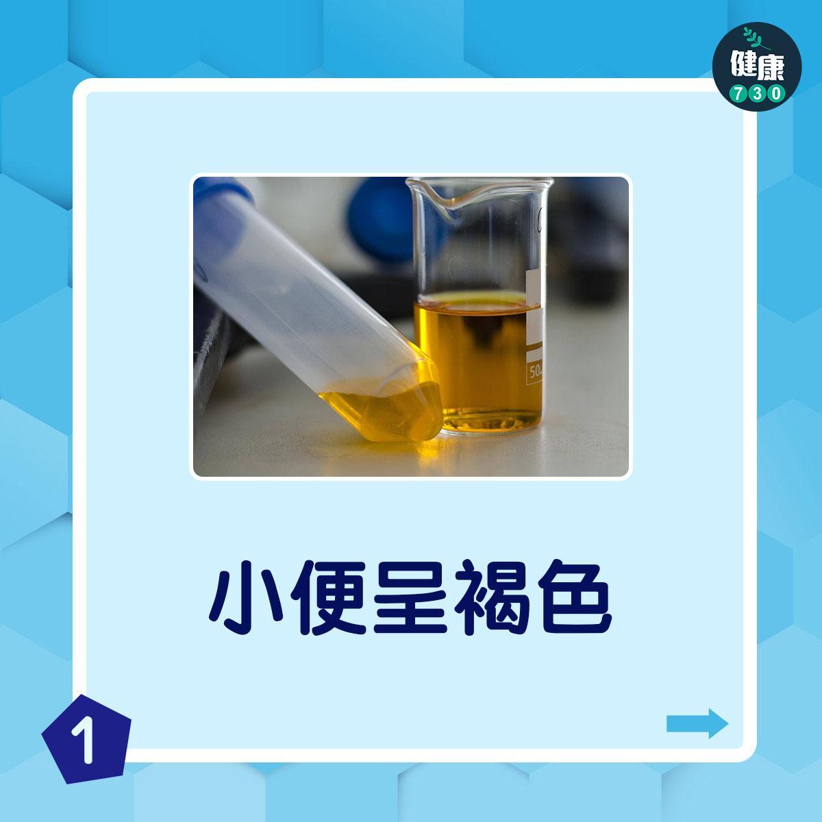 脫水症狀|小便呈褐色(am730製圖)