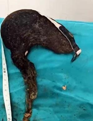 毛球裡混雜毛線、橡筋、木屑、小石頭等異物。(互聯網)