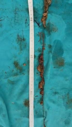 毛球裡混雜毛線、橡筋、木屑、小石頭等異物。(互聯網)