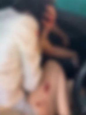 雙方爆發衝突,小三大腿受傷流血。(互聯網)