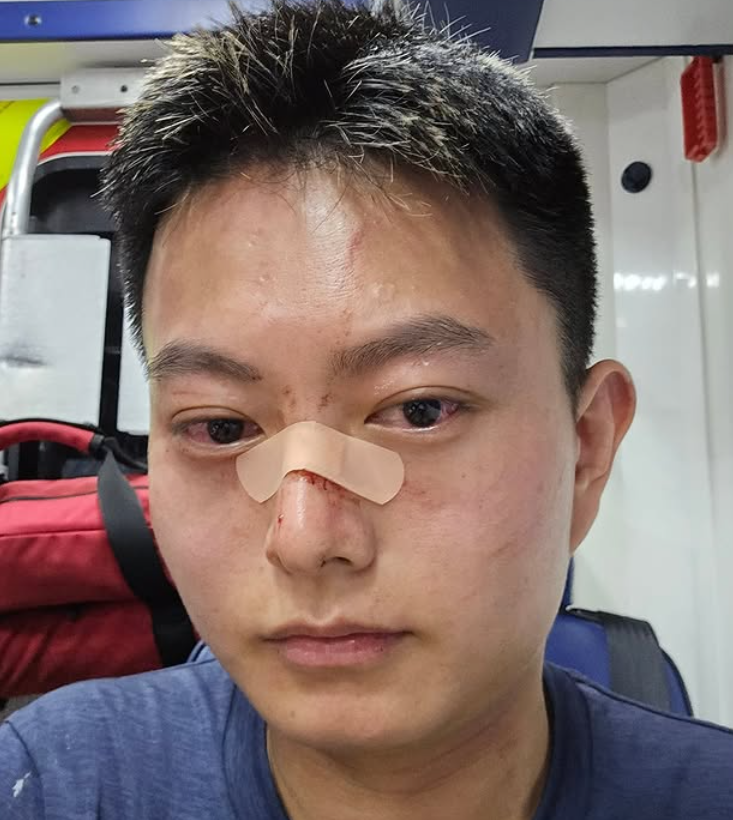 葉子健事後在社交平台Instagram上傳多則限時動態,他當時正在一間食肆與友人「打邊爐」;及後他鼻上染血並貼有膠布登上救護車稱:「頭先打邊爐嘅時候呢,劉馬車打咗我幾拳,打到我瞓低咗,而家上白車。」他在醫院亦與友人拍下合照,可見其上衣背後位置損毀。