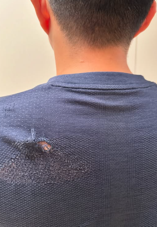 葉子健事後在社交平台Instagram上傳多則限時動態,他當時正在一間食肆與友人「打邊爐」;及後他鼻上染血並貼有膠布登上救護車稱:「頭先打邊爐嘅時候呢,劉馬車打咗我幾拳,打到我瞓低咗,而家上白車。」他在醫院亦與友人拍下合照,可見其上衣背後位置損毀。