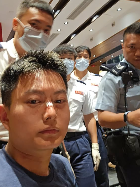 葉子健事後在社交平台Instagram上傳多則限時動態,他當時正在一間食肆與友人「打邊爐」;及後他鼻上染血並貼有膠布登上救護車稱:「頭先打邊爐嘅時候呢,劉馬車打咗我幾拳,打到我瞓低咗,而家上白車。」他在醫院亦與友人拍下合照,可見其上衣背後位置損毀。