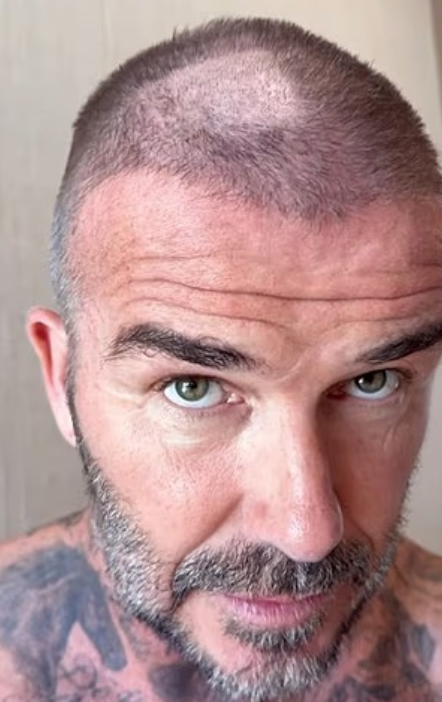 碧咸頭髮崩了一忽。(互聯網)